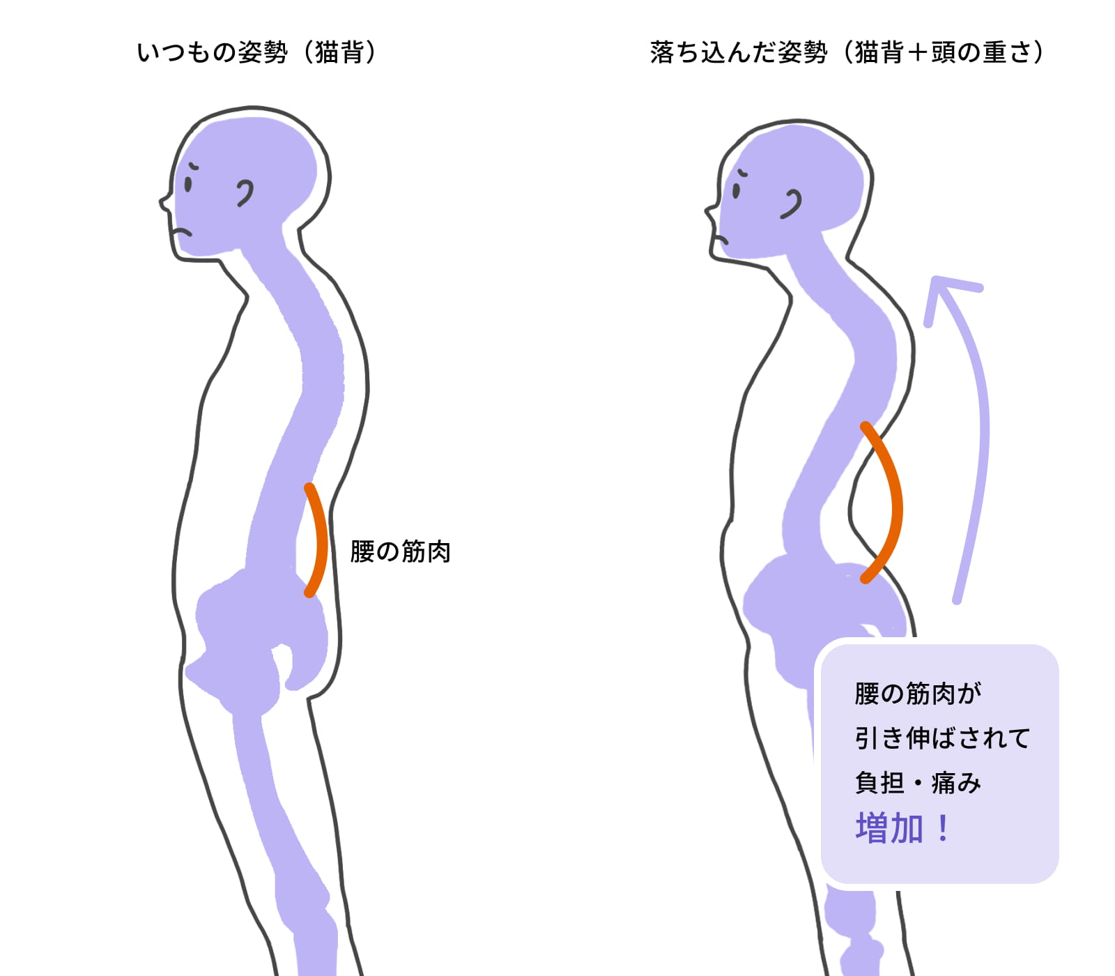 猫背と腰への負担の図解